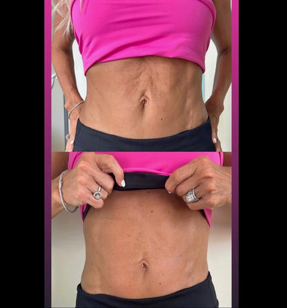 5 Sessions Body Contouring Packages with Gracie