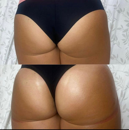 5 Sessions Body Contouring Packages with Gracie